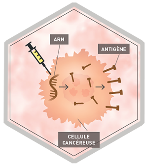 Infographie vaccins thérapeutiques
