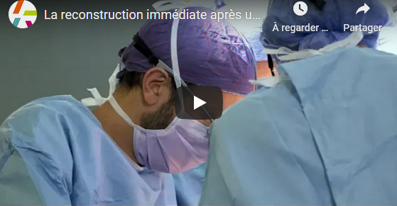La reconstruction immédiate après un cancer du sein à Gustave Roussy